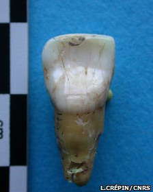 Серед останків знайшли і людські зуби