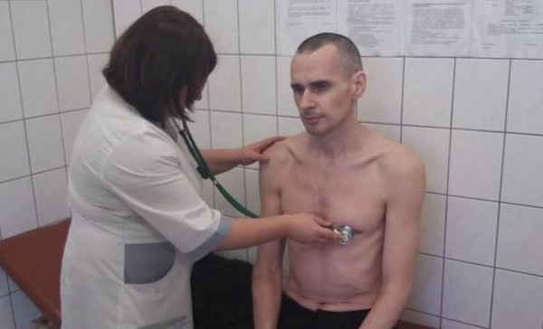 Політв’язні Кремля. Концтабірна медицина каже, що Сенцов не має проблем зі здоров’ям